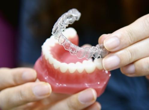 Invisalign clear aligners in columbia md