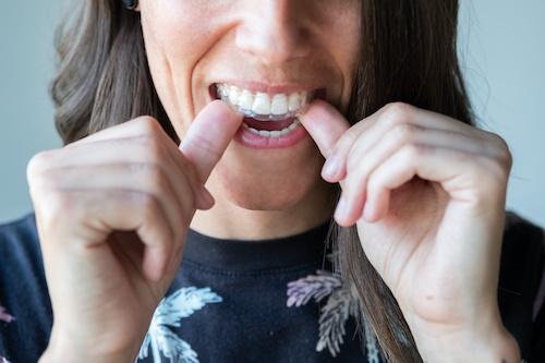 Lady putting Invisalign at Pineview Dental in Columbia, MD