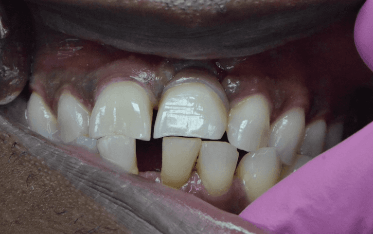 Restoring-What-s-Missing-After-Image