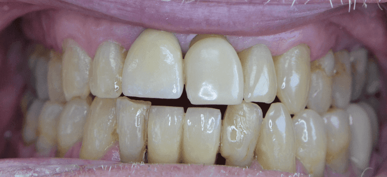 Smile-Restored-Before-Image