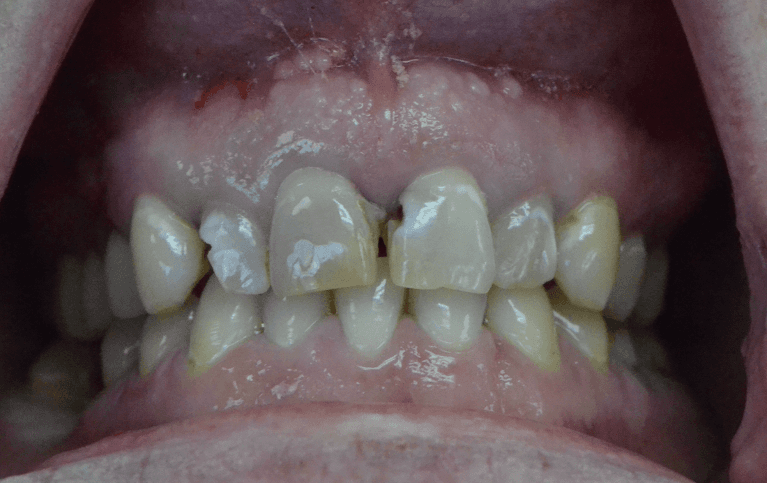 From-Decay-to-Beautiful-Before-Image