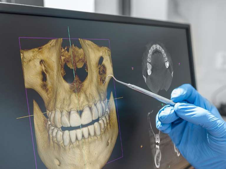 3-D Cone Beam Imaging (CBCT) technology at Pineview Dental in Columbia, MD