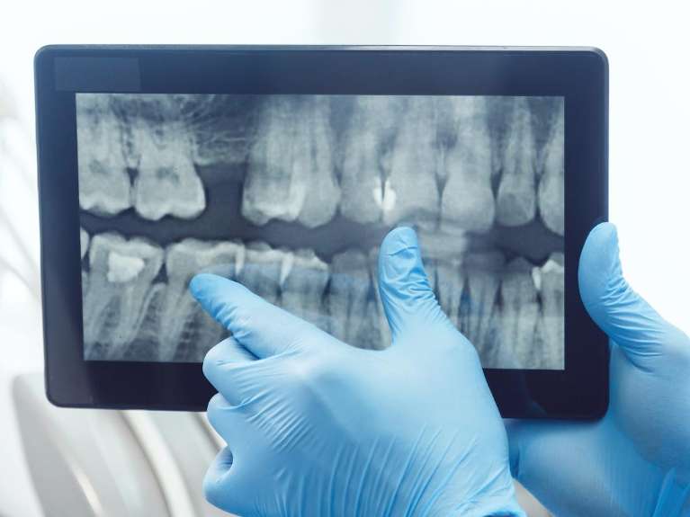 Digital X-Rays & Sensors technology at Pineview Dental in Columbia, MD