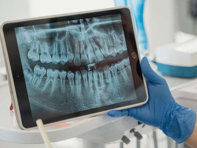 Panoramic X-Rays technology at Pineview Dental in Columbia, MD